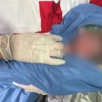 Protección Civil atiende parto en domicilio en Santa Catarina